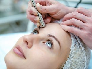 The microdermabrasion